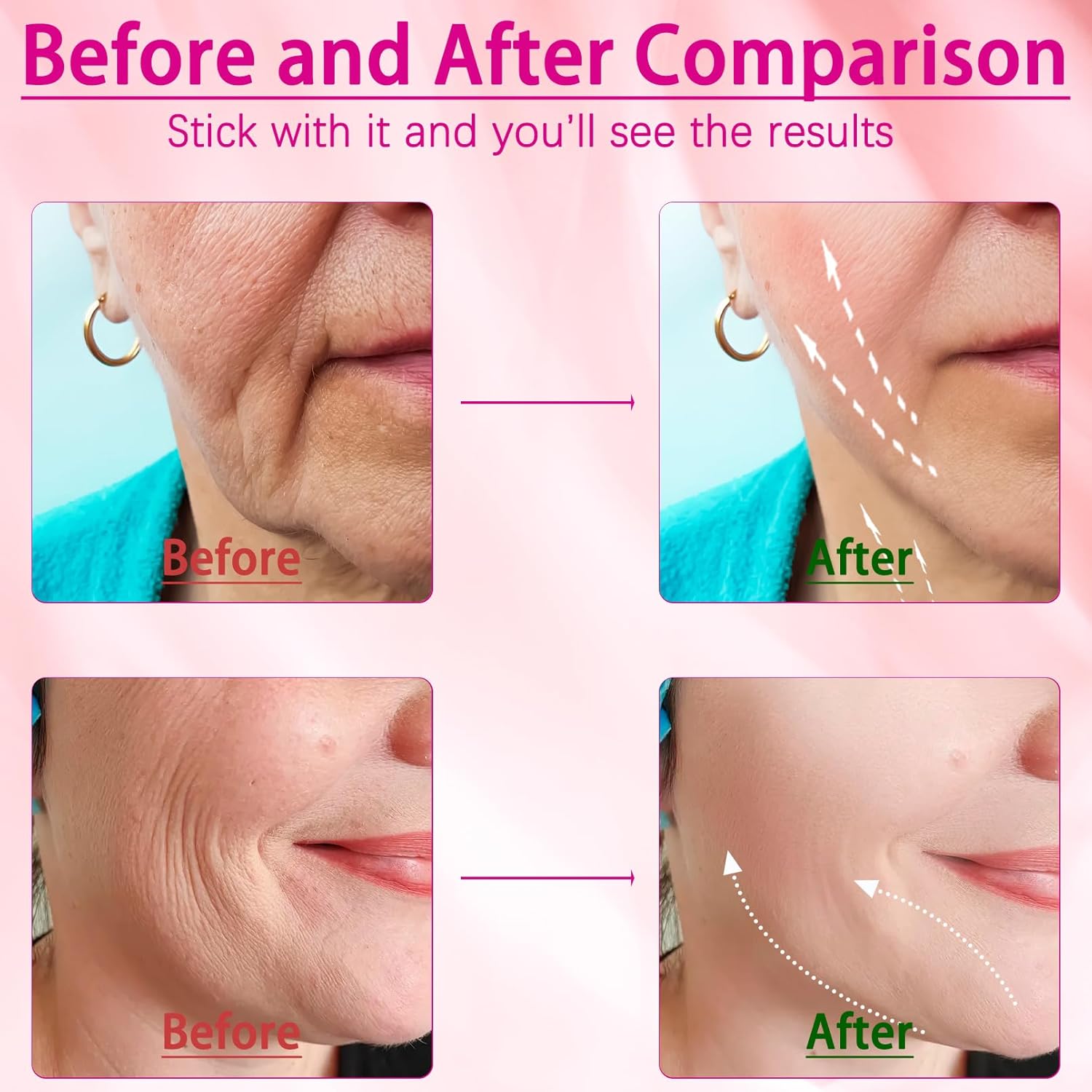 Noveaura™  Face Massager | Anti-Aging | Skin Tightening | Wrinkle Reducer
