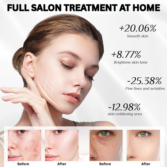 GlowSpa™ - Home Spa Skin Rejuvenation Machine With Nano Spray